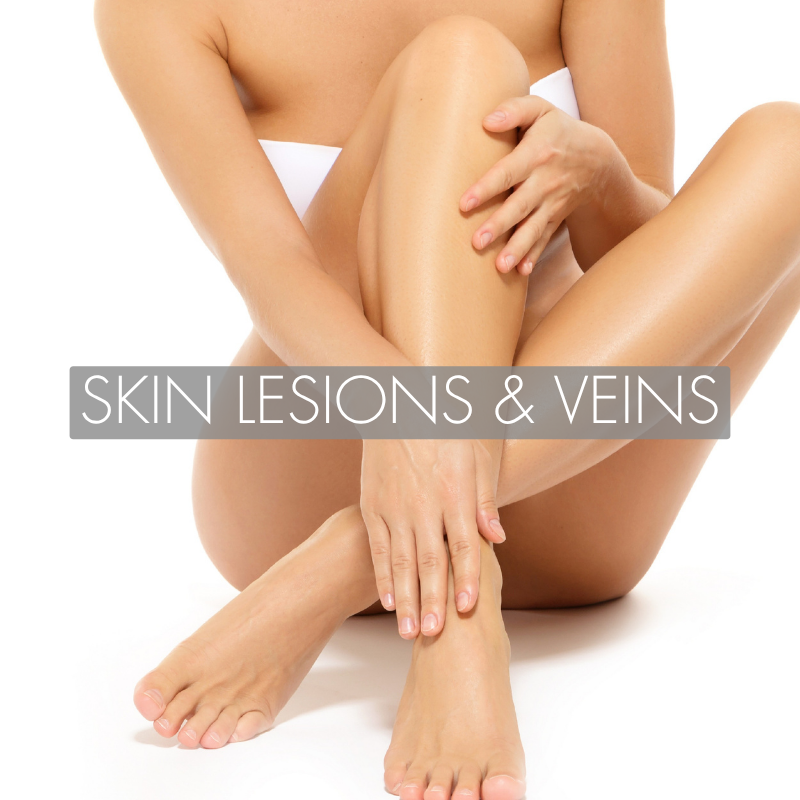 
    Skin Lesions and Veins
  