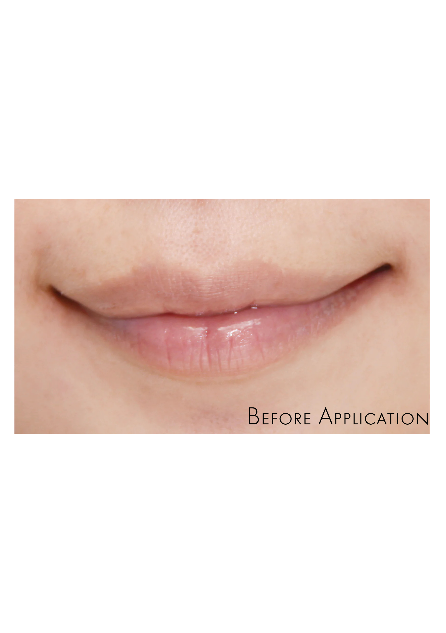 Luscious Lips - Aesthetica Skin Centre