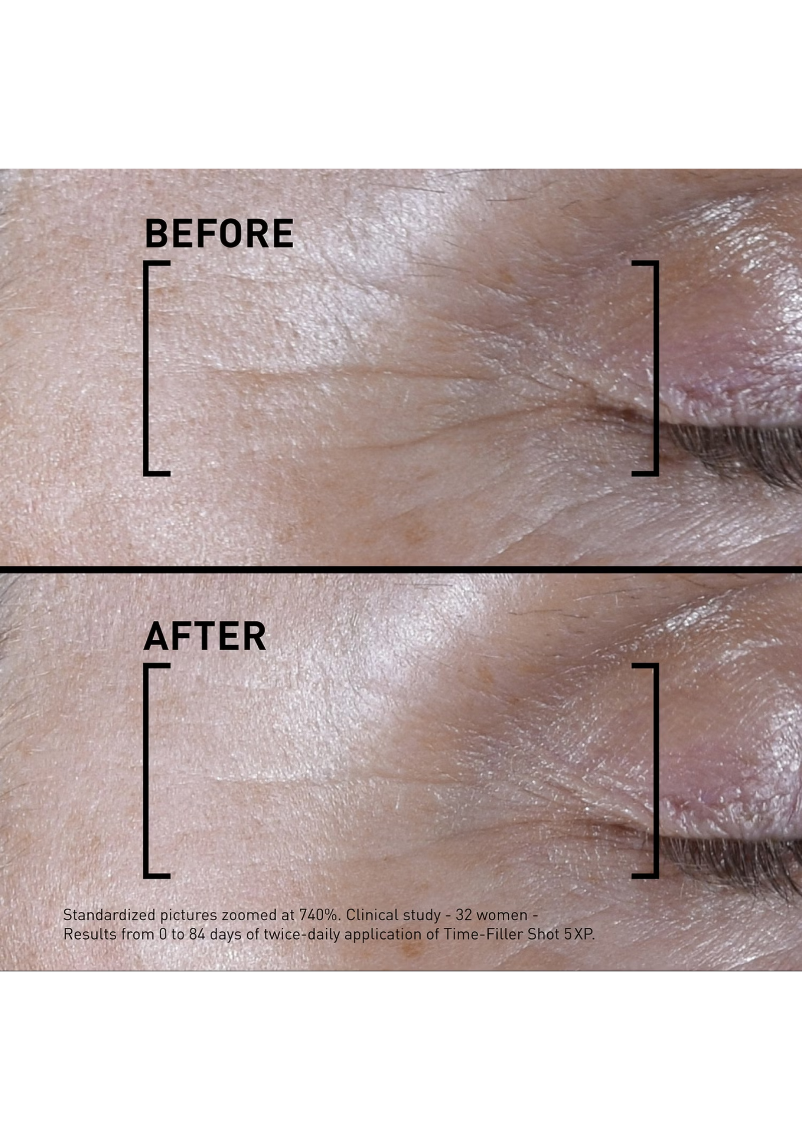 Filorga® Time Filler Shot 5XP Pen