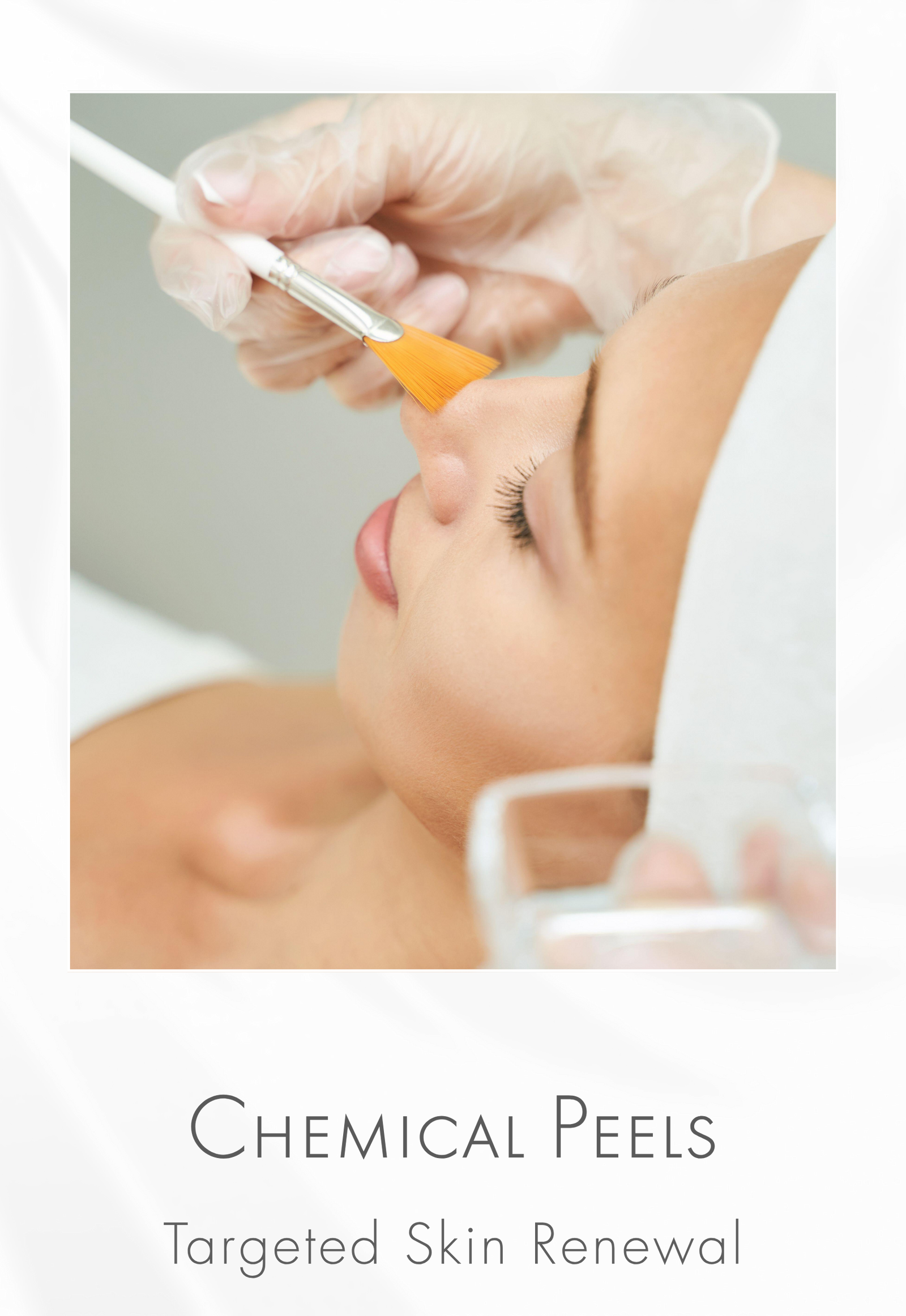Chemical Peeling Systems