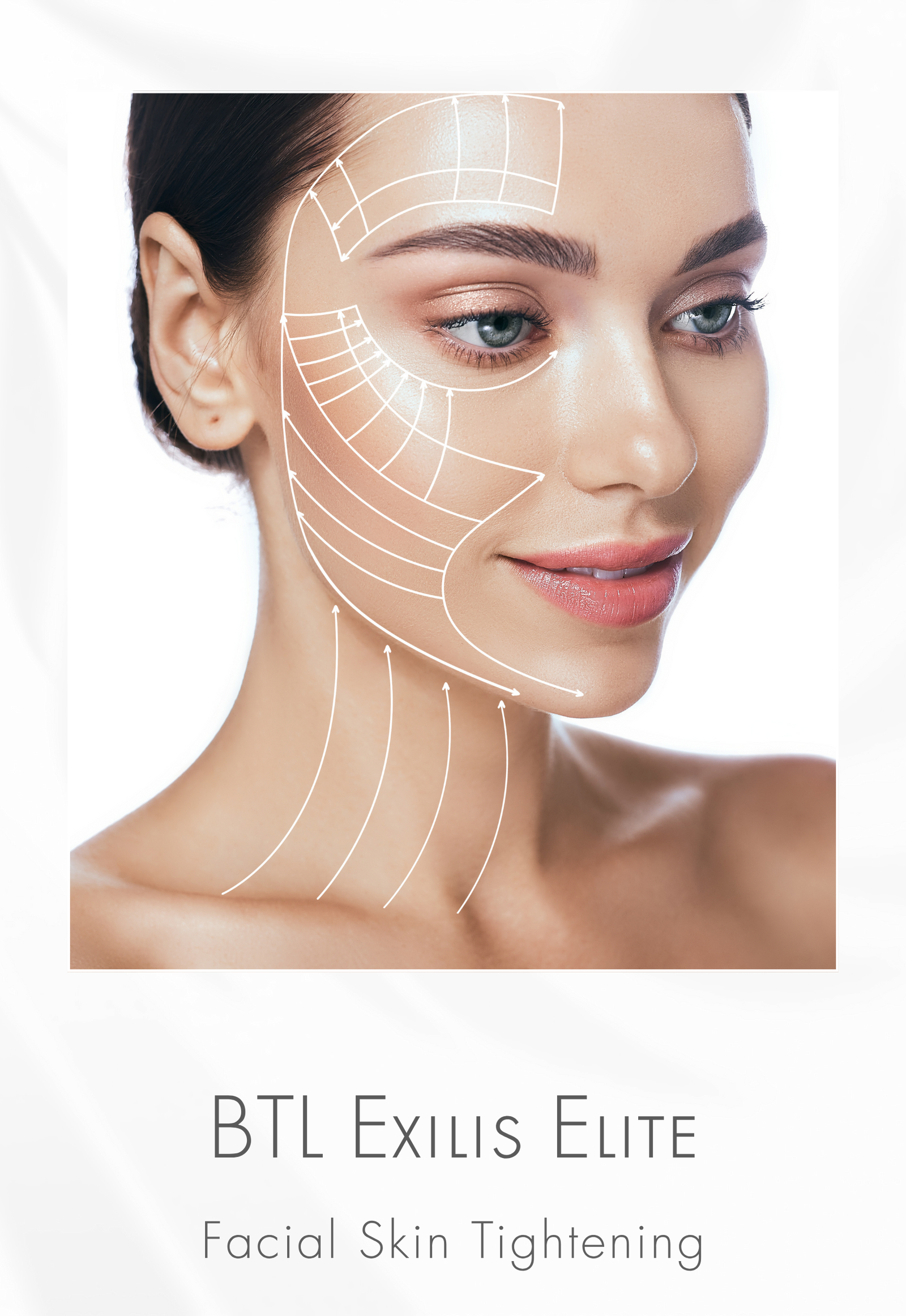 Exilis® Elite Face