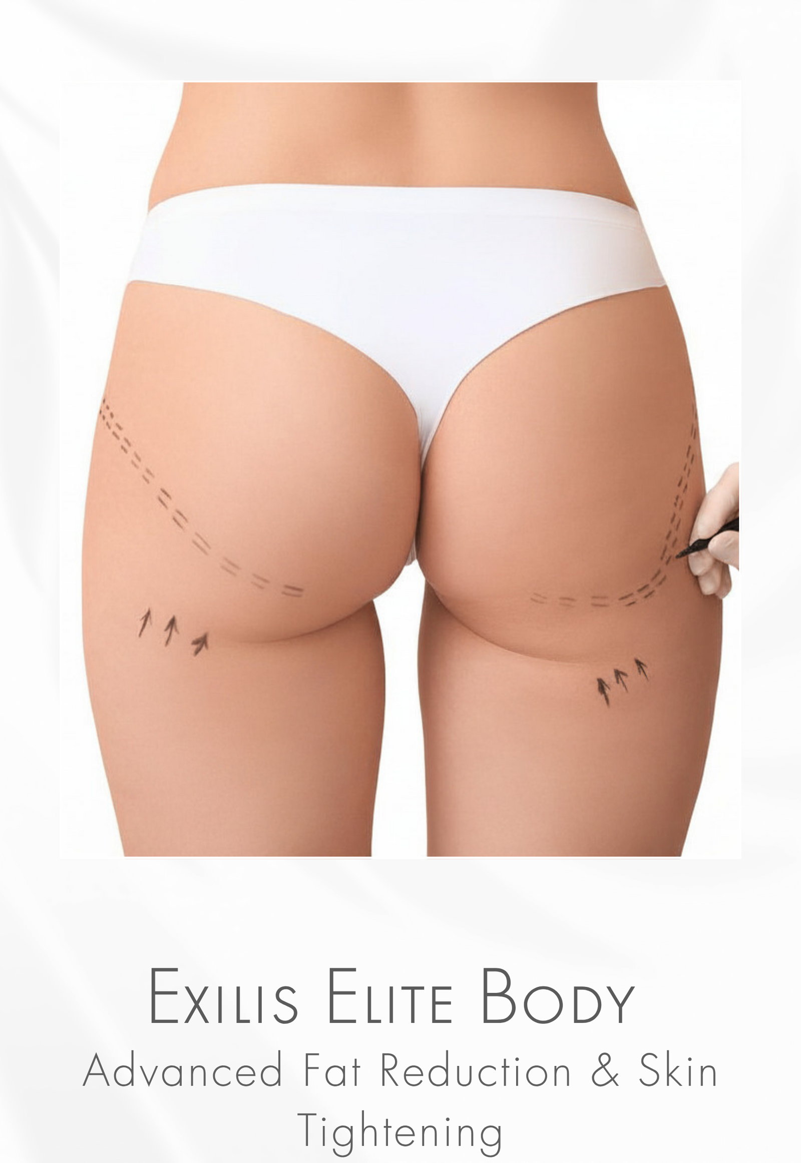 Exilis™ Elite for Body