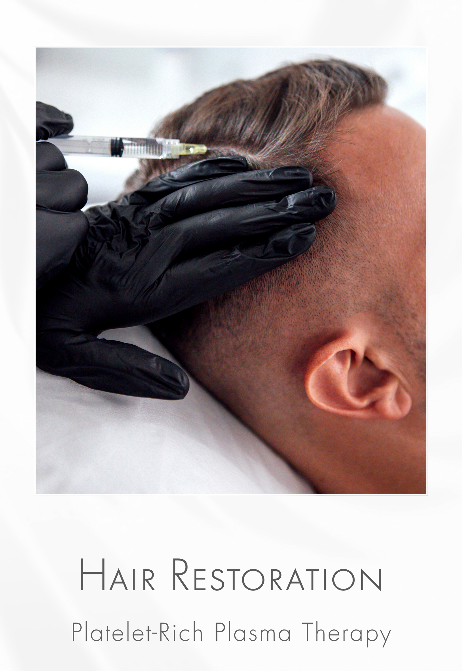 PRP Hair Restoration Therapy