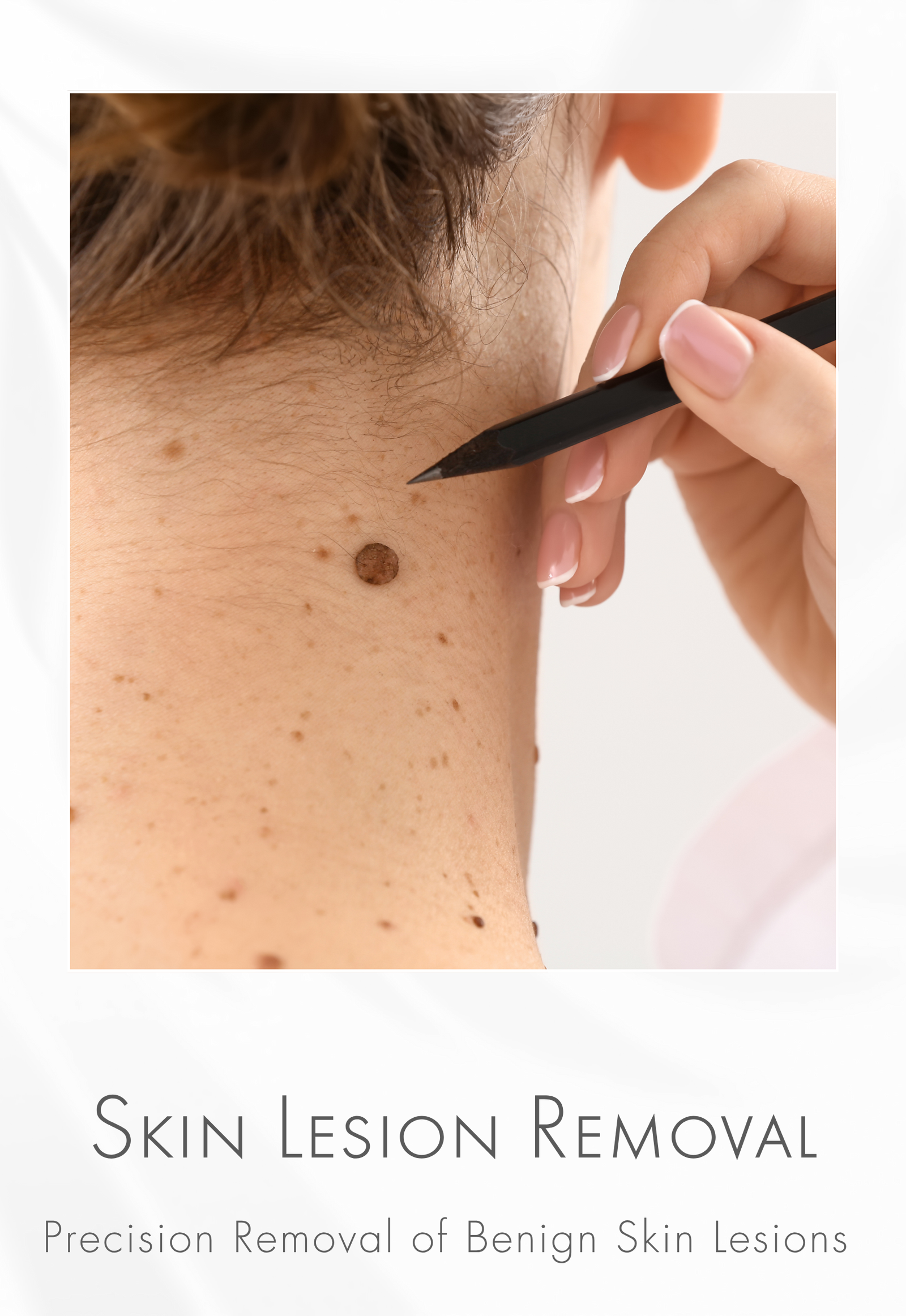Plasmatek™ Wireless for Skin Lesions