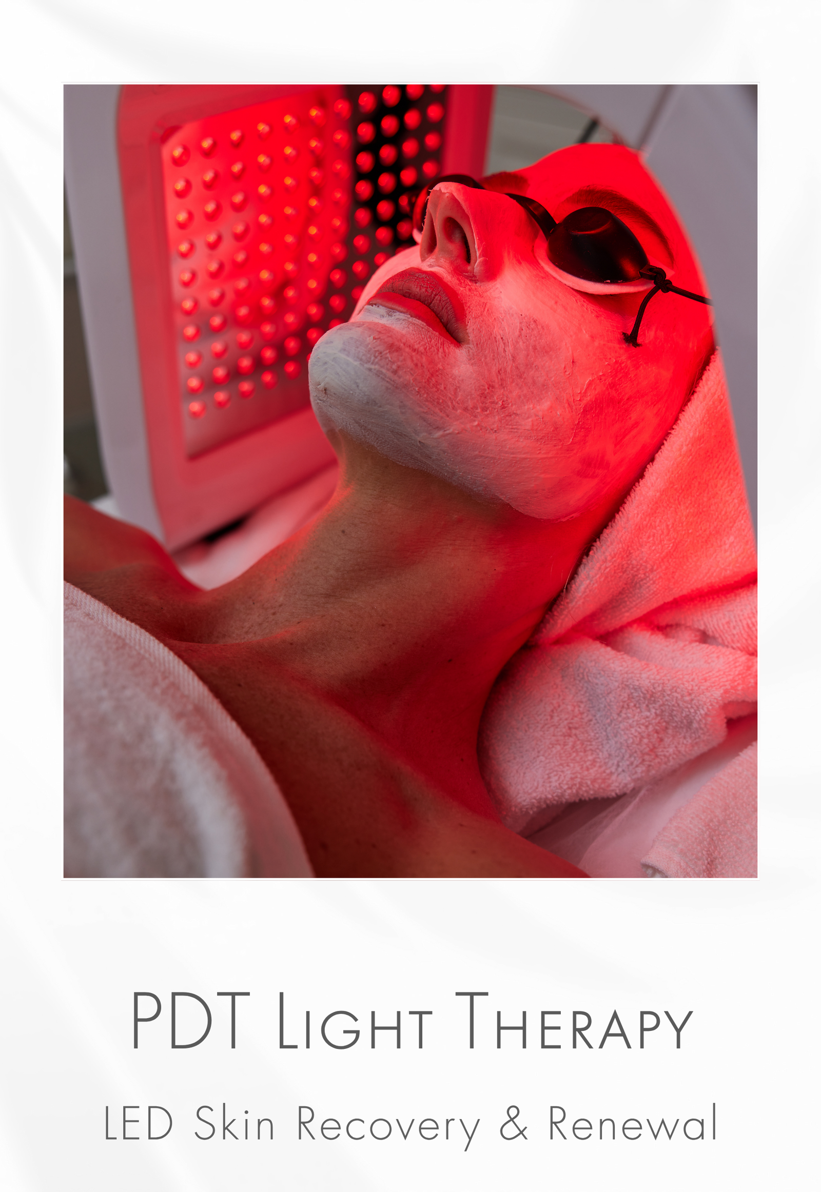 Photo Dynamic Therapy (PDT Light Therapy)