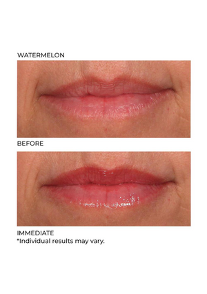 Nassif MD® Hydro-Screen For Lips