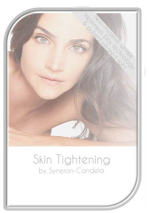 Syneron ePlus® Sublime Skin Tightening Procedure