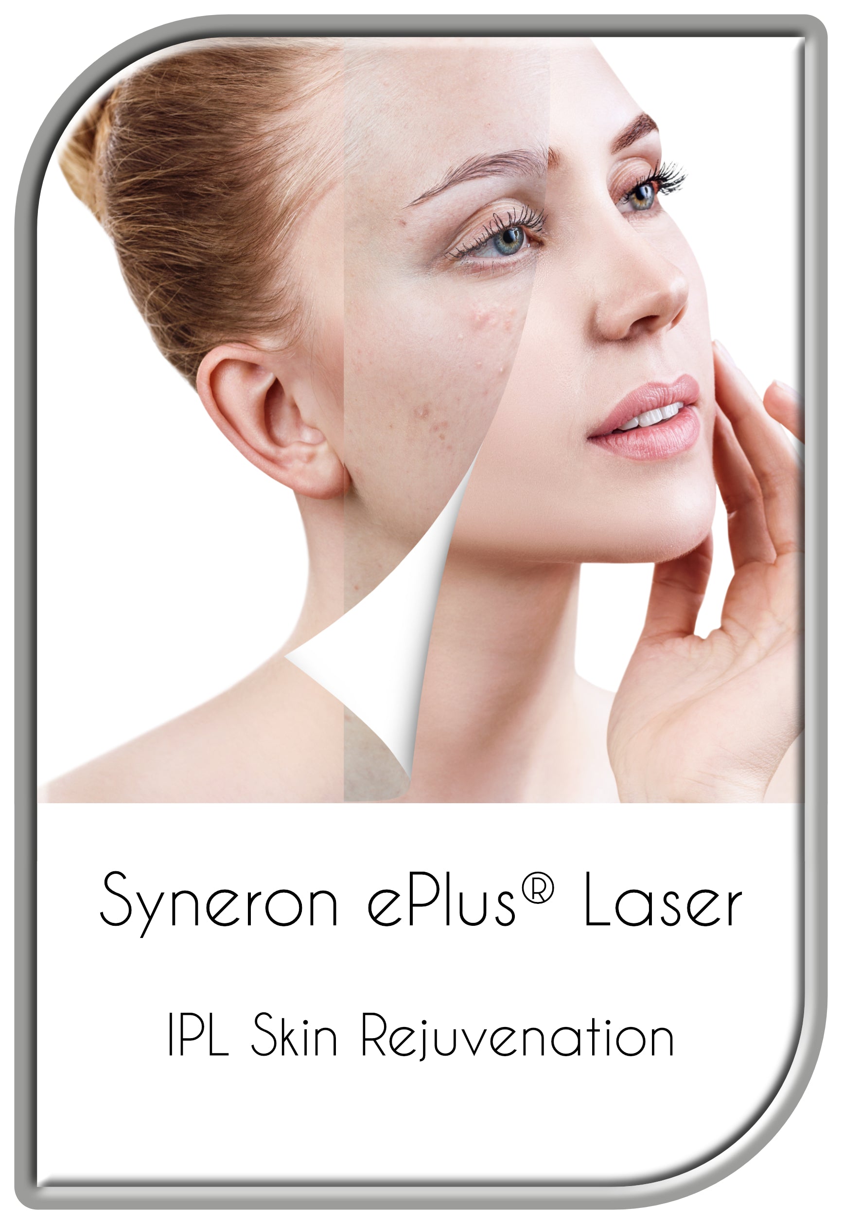 Syneron ePlus® IPL Skin Rejuvenation Procedure