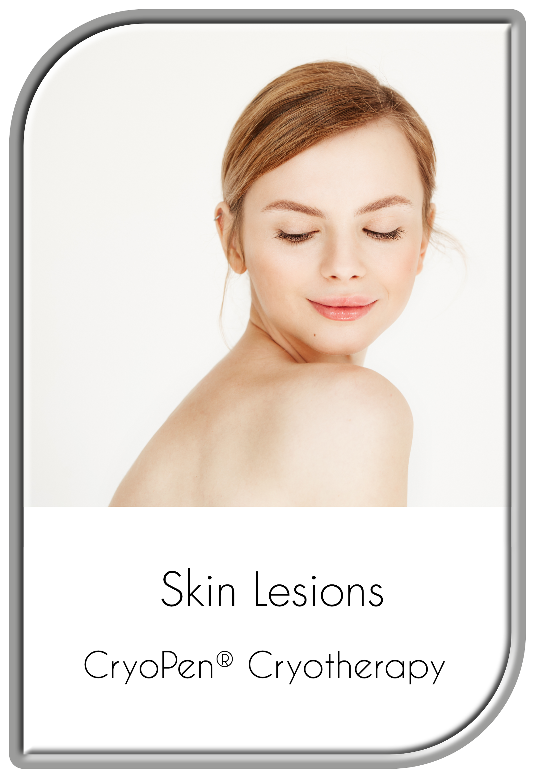 Cryotherapy for Skin Lesions