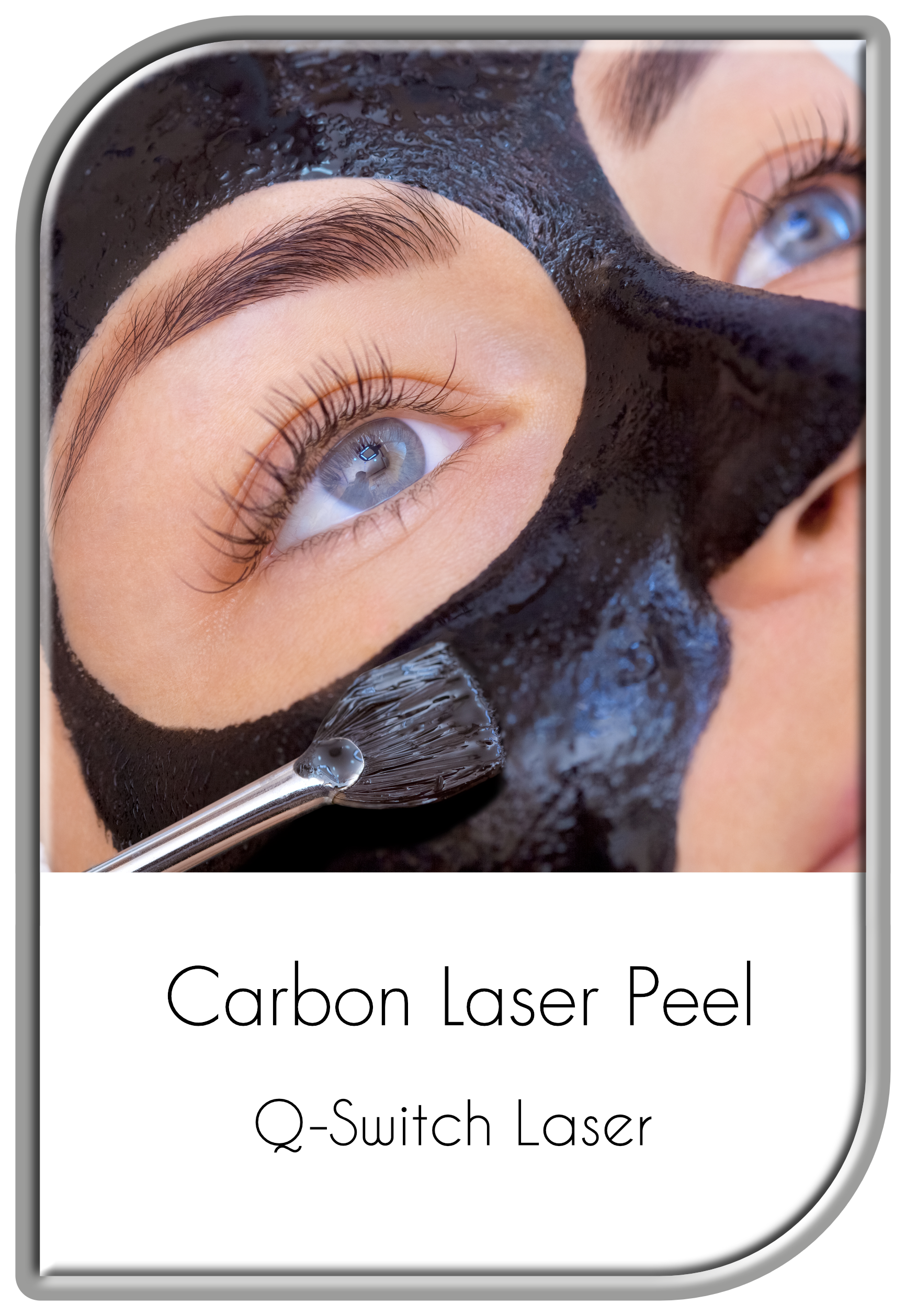 Carbon Laser Peel