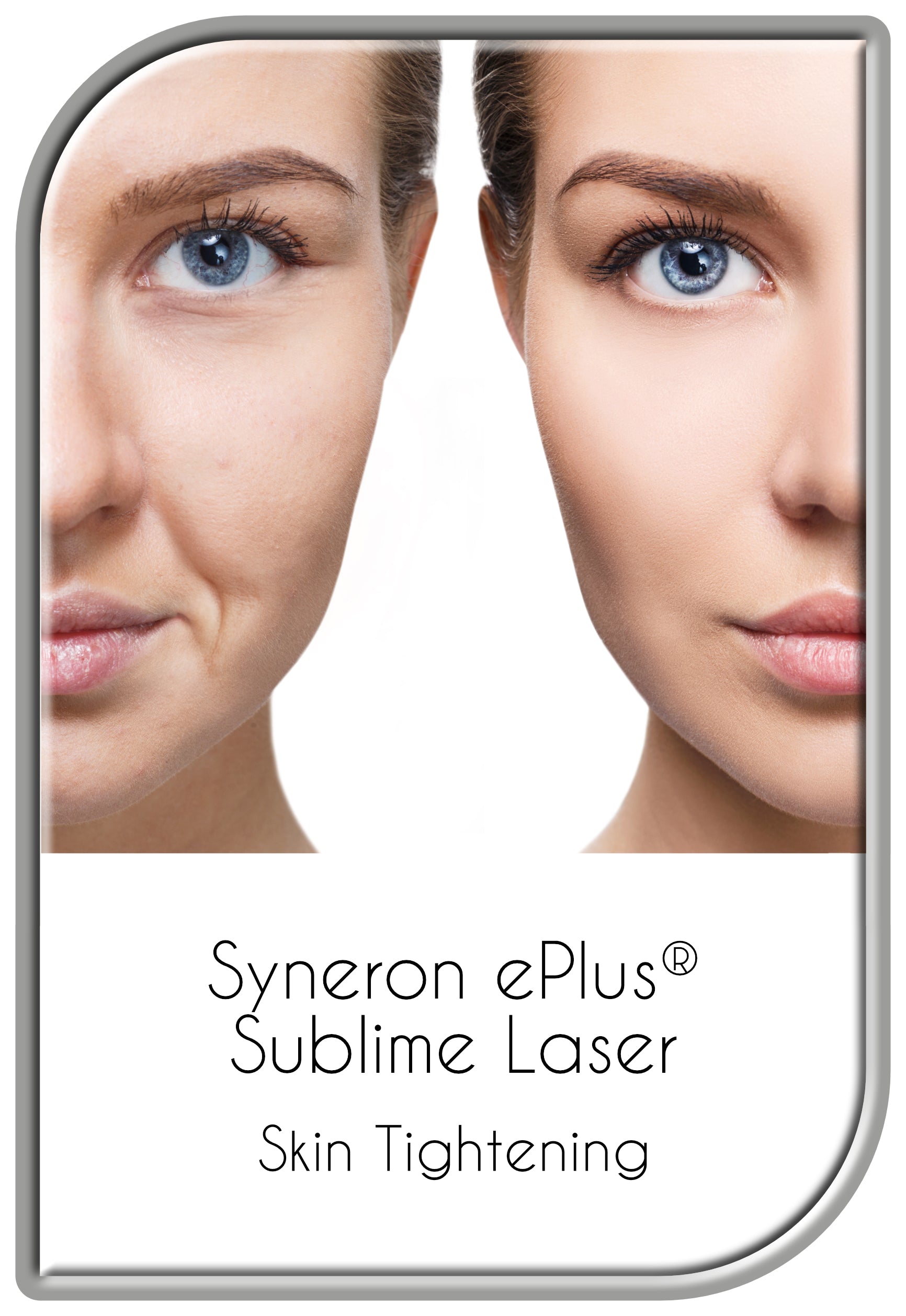 Syneron ePlus® Sublime Skin Tightening Procedure