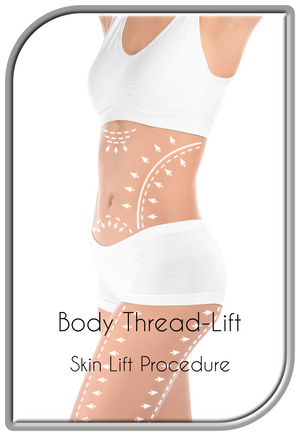 Body Thread-Lift Procedure