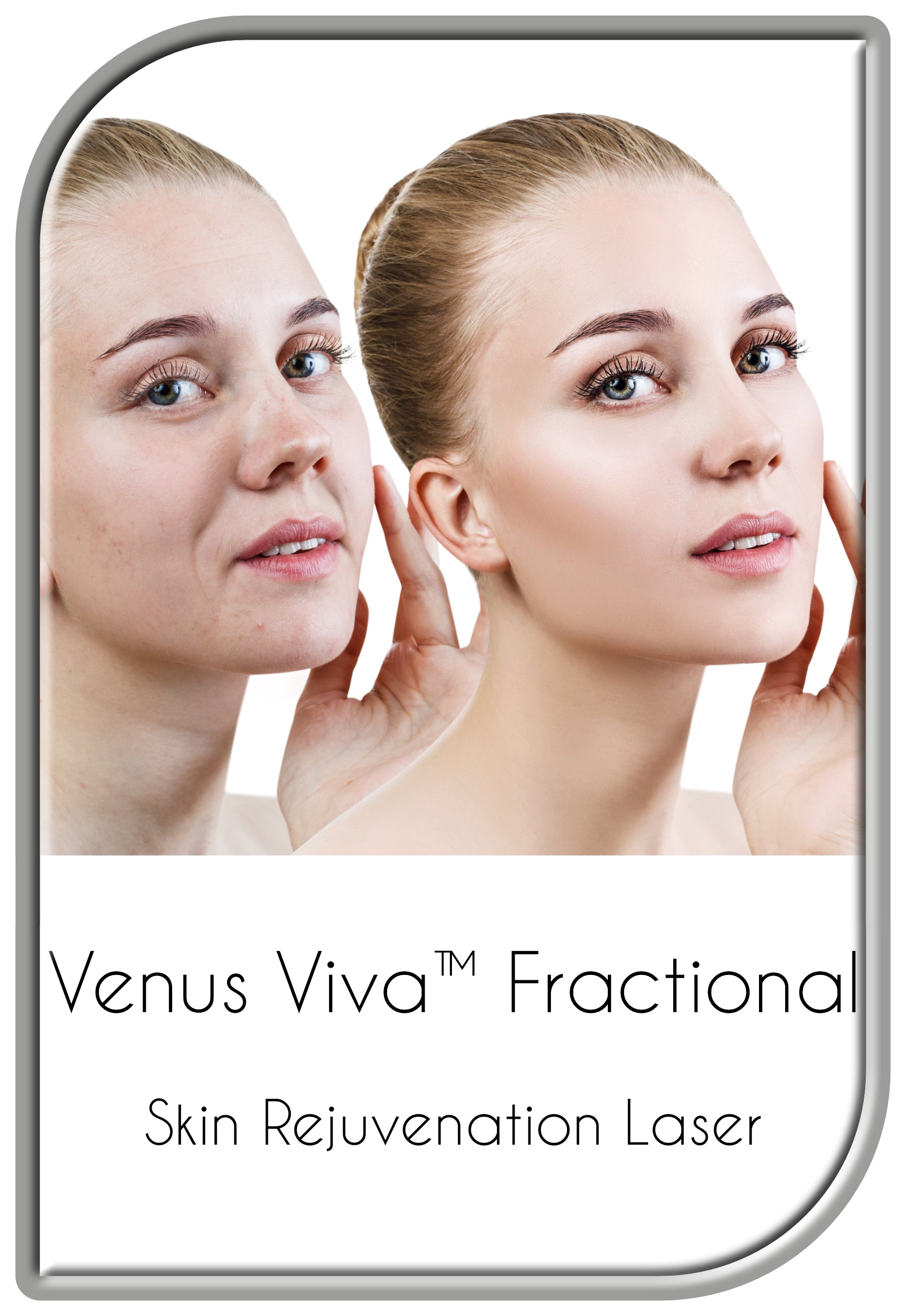 Venus Viva™ Fractional